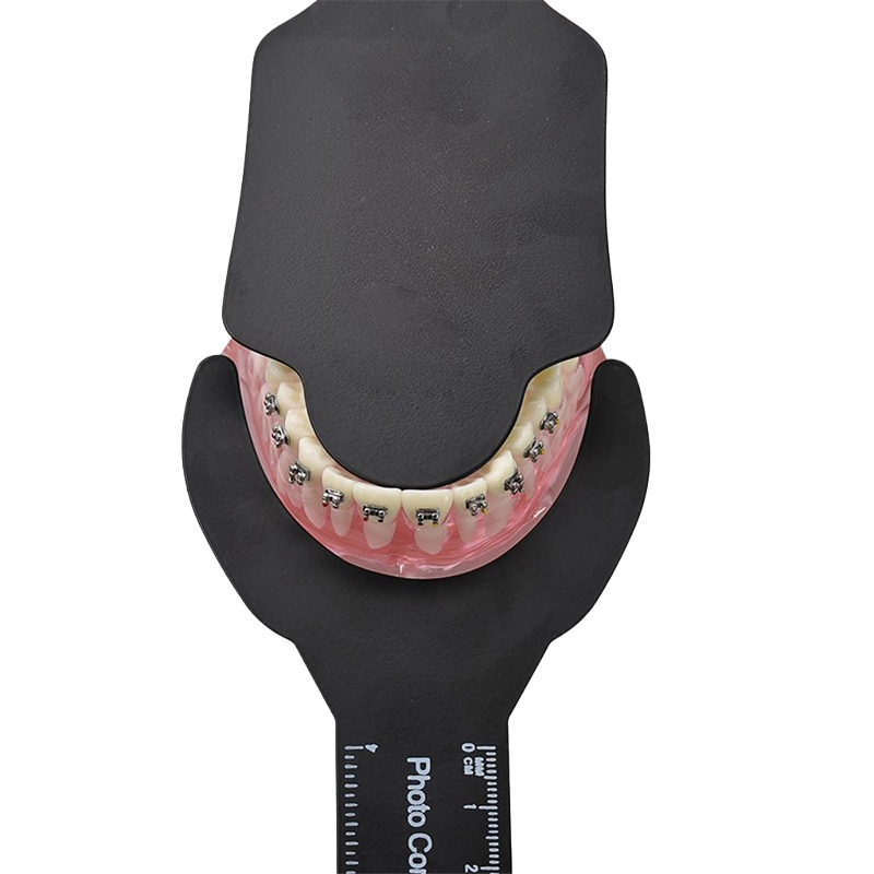 Photography Dental - Dental Photography dentistry Photo Contrast kit