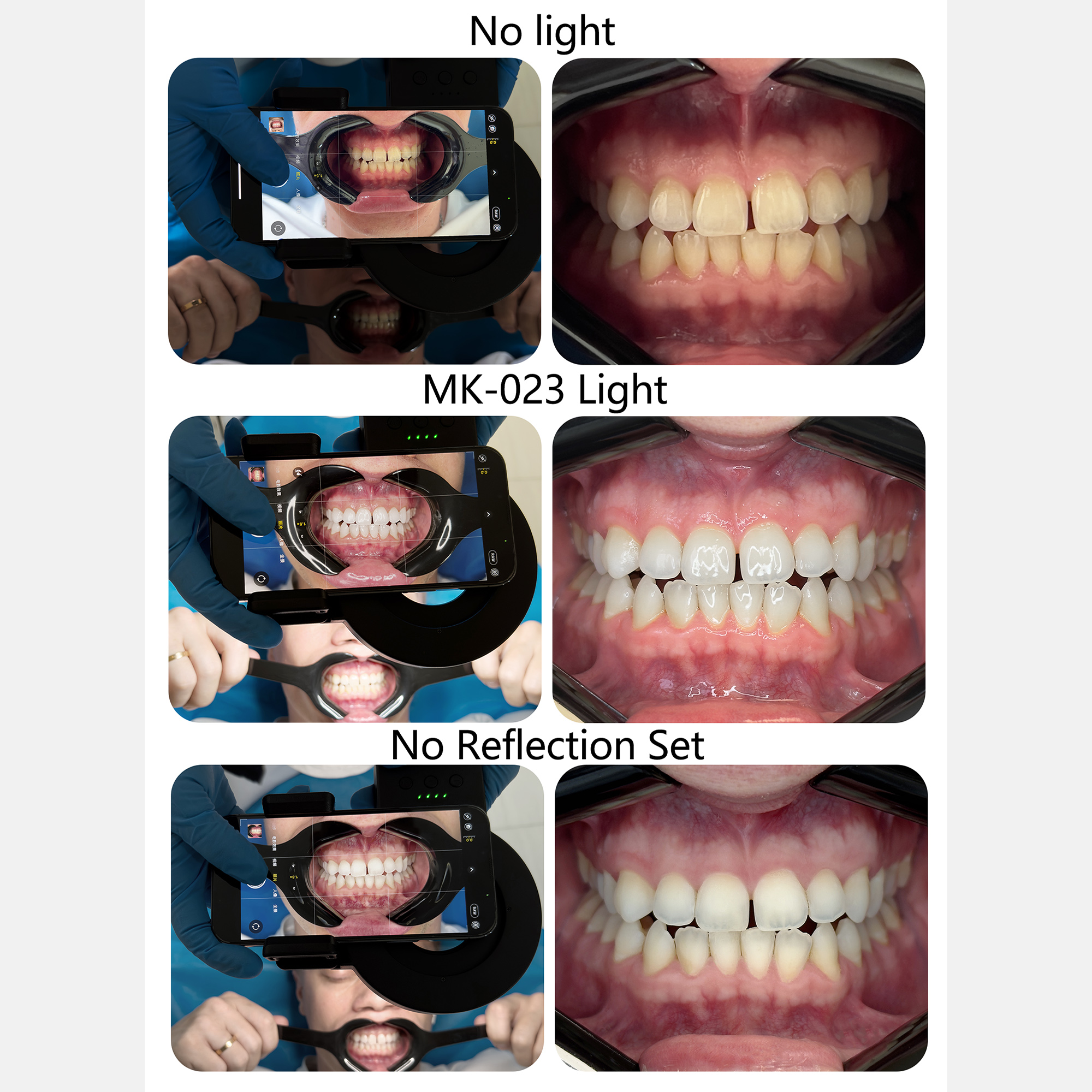 HERA MK-23 Intraoral Dental Ph - Photography Dental recension och pris