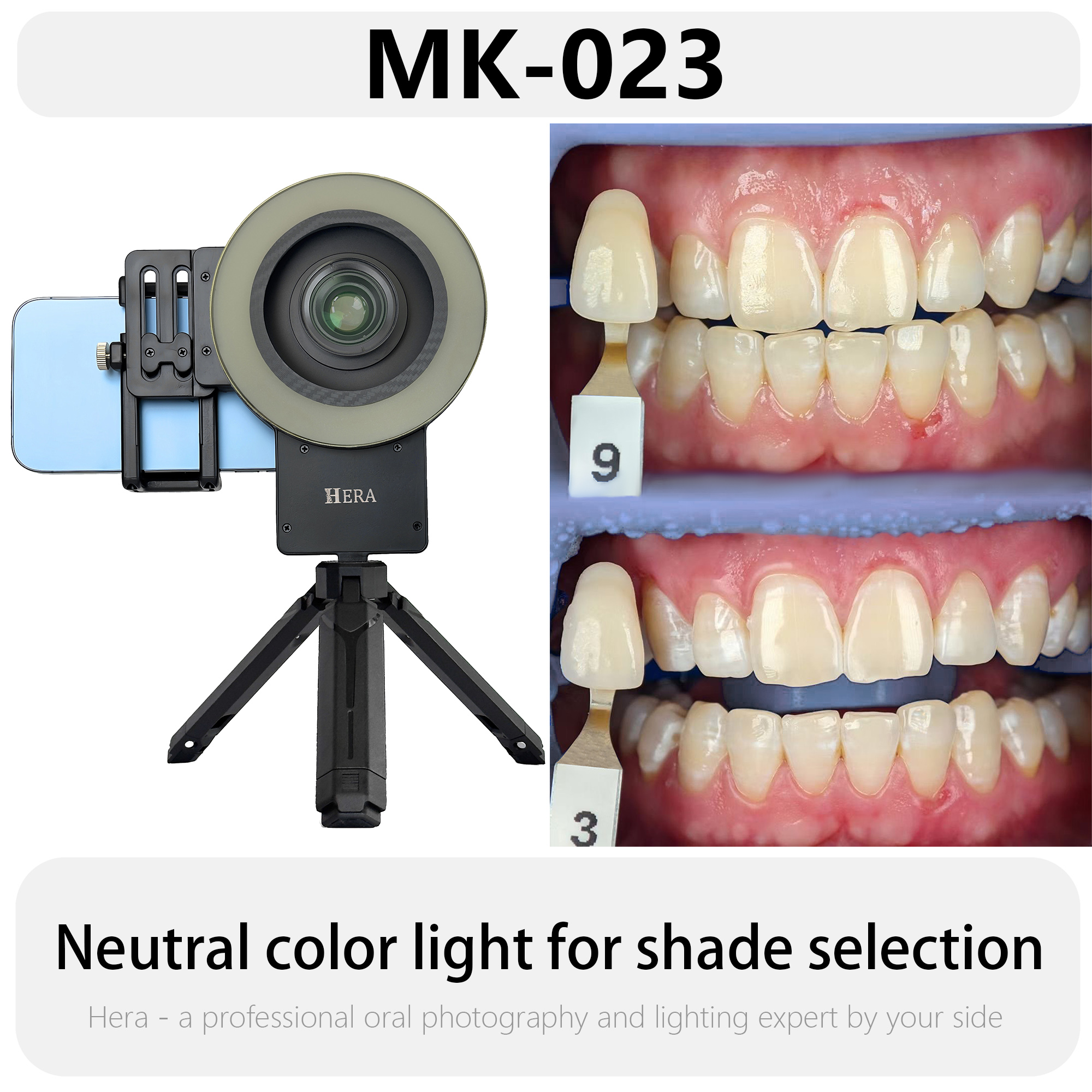 HERA MK-23 Intraoral Dental Ph - Photography Dental recension och pris