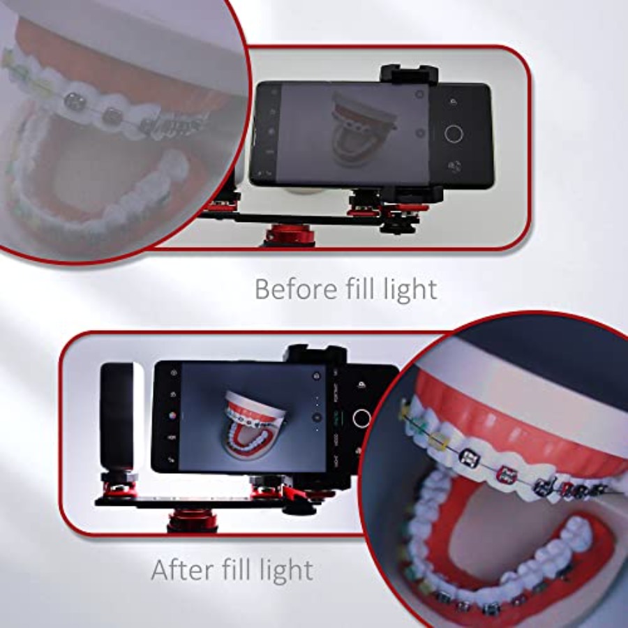 Bluetooth Dental Flash Light P - Photography Dental recension och pris