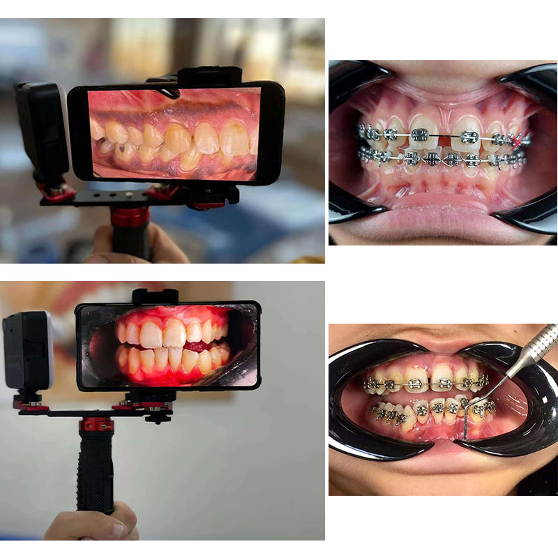 Dentistry Material Mobile Phon - Photography Dental recension och pris