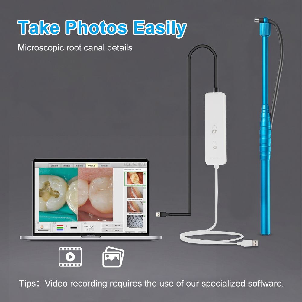 5MP Micro Intraoral Camera Den - Photography Dental recension och pris